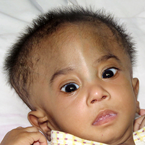 Healthcare Charities Inc Baby of Sainaba Mohammed Mustafa